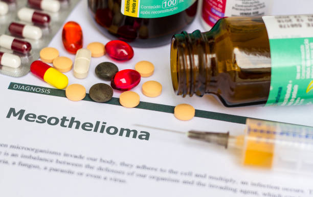 3 Common Myths About Mesothelioma Claims